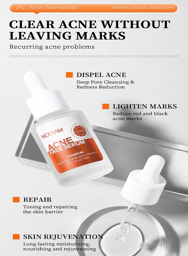MOOYAM Acne Face Serum-Salicylic Acid Acne Repair Serum,Salicylic Acid Oil Control Acne Treatment Essence, Anti-Acne Exfoliating Gentle Salicylic Acid Serum, Promote the Renewal of Epidermal Cells, Delicate Skin 30ML  - Image 3