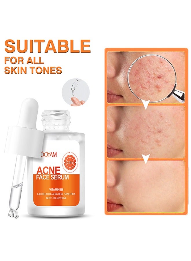 MOOYAM Acne Face Serum-Salicylic Acid Acne Repair Serum,Salicylic Acid Oil Control Acne Treatment Essence, Anti-Acne Exfoliating Gentle Salicylic Acid Serum, Promote the Renewal of Epidermal Cells, Delicate Skin 30ML  - Image 1