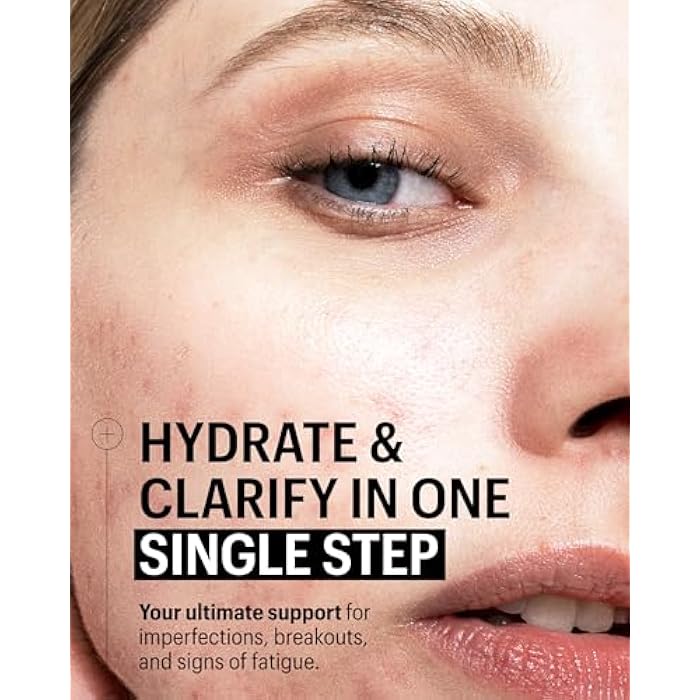 Allies of Skin Multi Nutrient & Dioic Renewing Face Cream | Balance and Hydrate Acne Prone Skin with Kombucha & Probiotics | Calm Redness, Breakouts and Even Skin Tone | 1.7 fl oz - Image 3