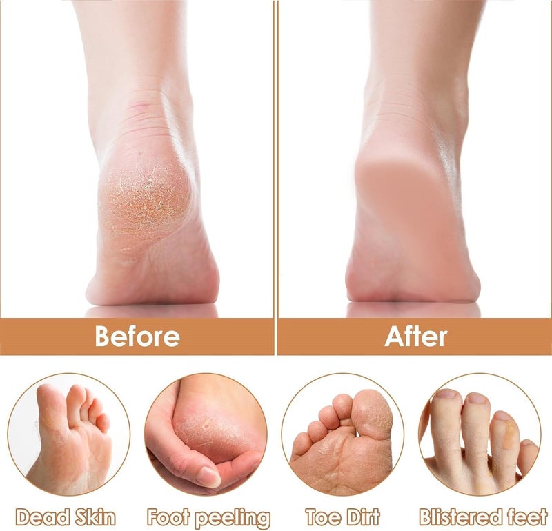 Lonimia مبرد القدم الاحترافي من Lonimia، مقشر القدم، مبارد القدم، بمقبض خشبي غير قابل للانزلاق، تنظيف قوي ومريح، أدوات تمريض محمولة، مناسبة للقدمين واليدين والمرفقين والكعبين - Image 5