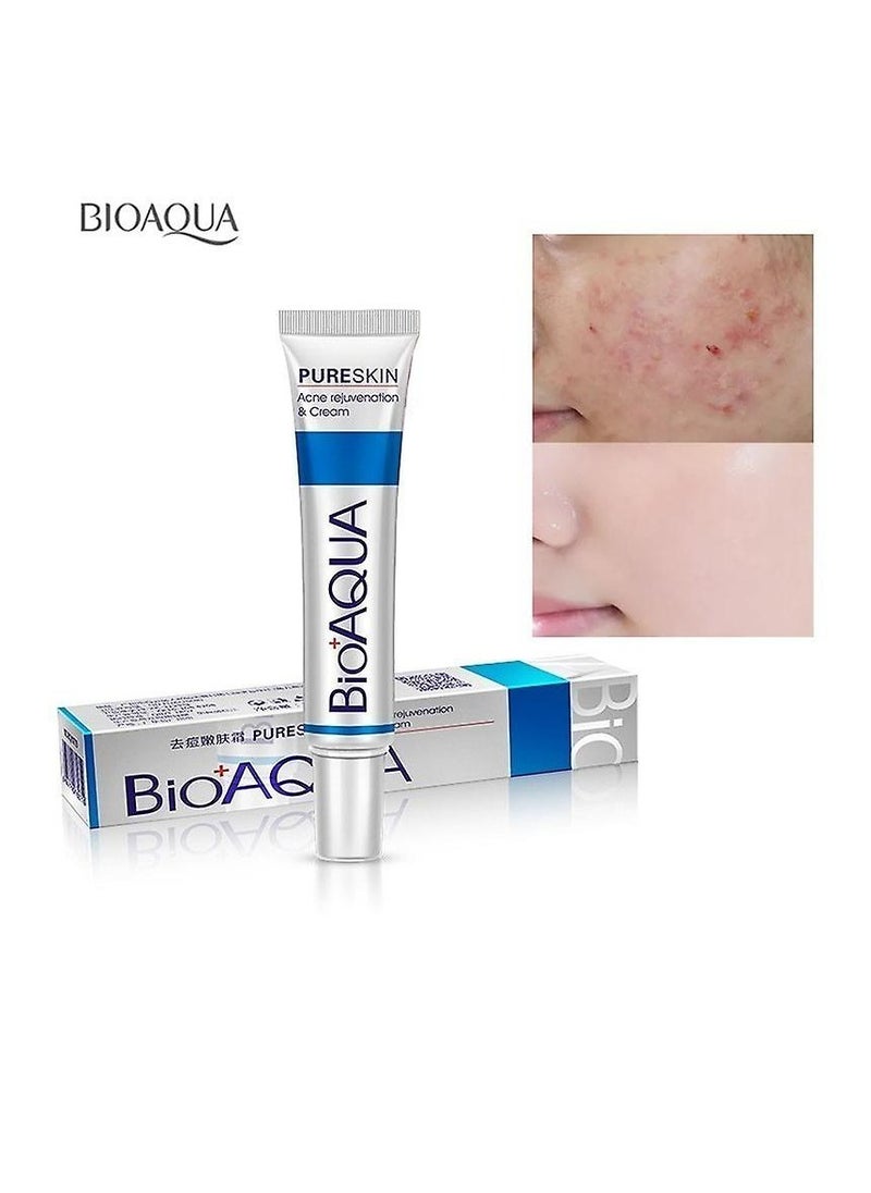 بيو أكوا - كريم BIOAQUA للوجه المضاد لحب الشباب - Image 1