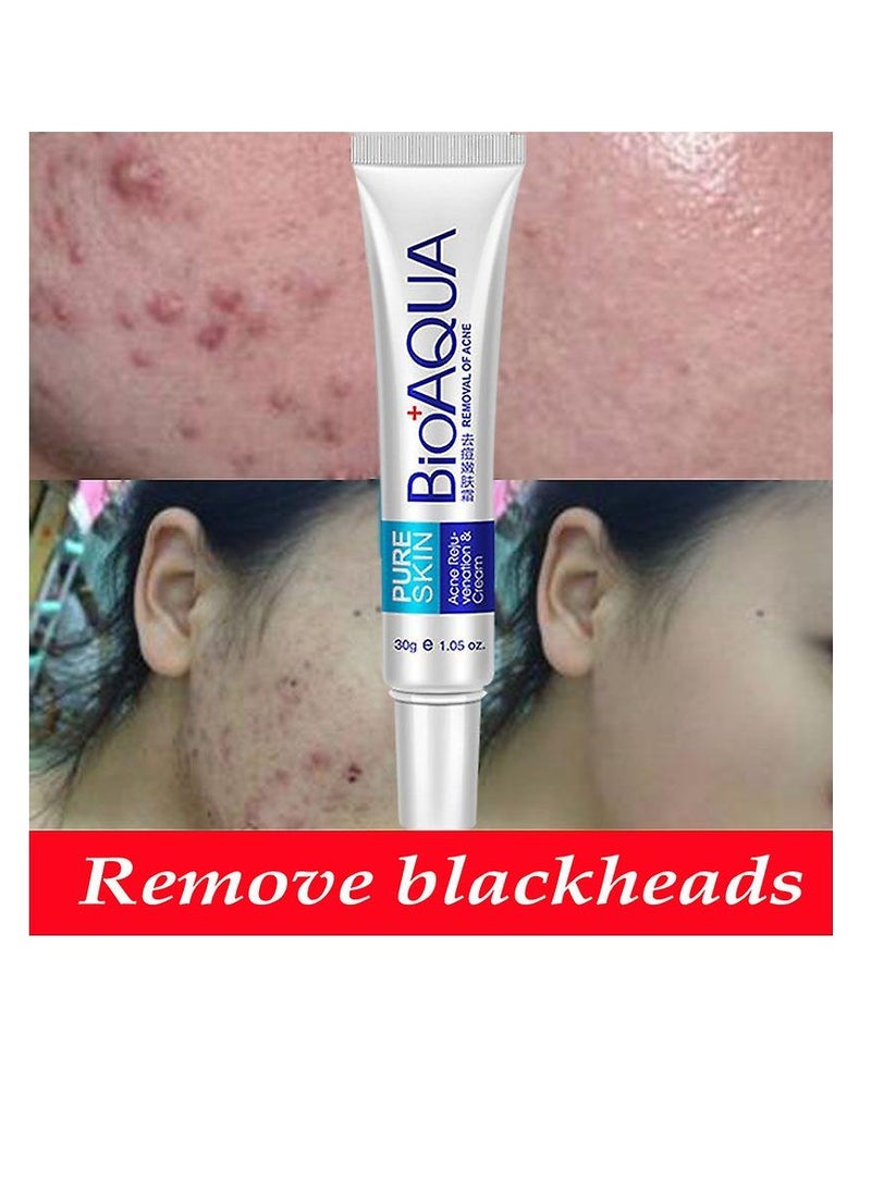 بيو أكوا - كريم BIOAQUA للوجه المضاد لحب الشباب - Image 1