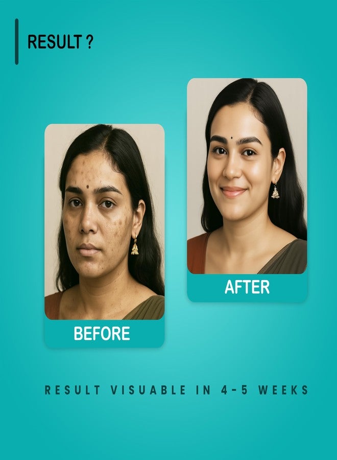 Ayumcure 0.5% Retinol Night Cream | 50g | With 1% Hyaluronic Acid, 1% Glutathione & 0.5% Alpha Arbutin | Brightens, Evens Skin Tone & Reduces Dark Spots | Unisex | All Skin Types - Image 4
