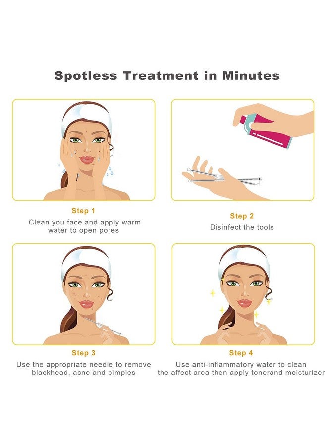 TWIREY Stainless Steel Blackhead Remover Needle Round & Pointed Tip (Pack Of 2) - Image 2