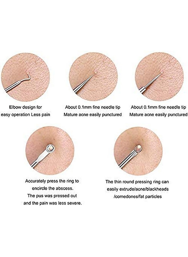 TWIREY Stainless Steel Blackhead Remover Needle Round & Pointed Tip (Pack Of 2) - Image 3