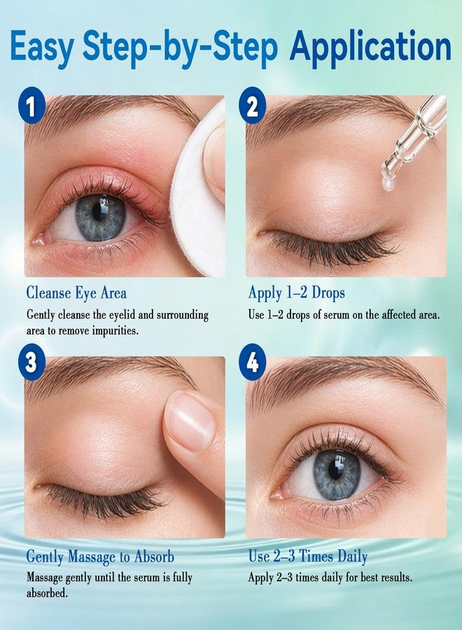 Nexkayee Stye Eye Treatment Serum for Irritation Relief, Soothing Formula for Stye and Chalazion Care, Gentle Daily Use Eye Serum, Helps Reduce Redness and Puffiness, Easy Dropper Application, 30ML - Image 5