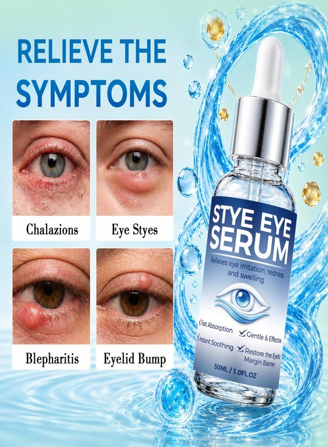 Nexkayee Stye Eye Treatment Serum for Irritation Relief, Soothing Formula for Stye and Chalazion Care, Gentle Daily Use Eye Serum, Helps Reduce Redness and Puffiness, Easy Dropper Application, 30ML - Image 4