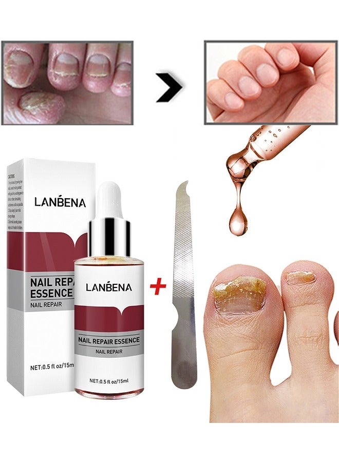 LANBENA Nail Repair Essence, Nail repair, repairs and renews damaged, broken, cracked and discolored nails (15ml) - Image 1