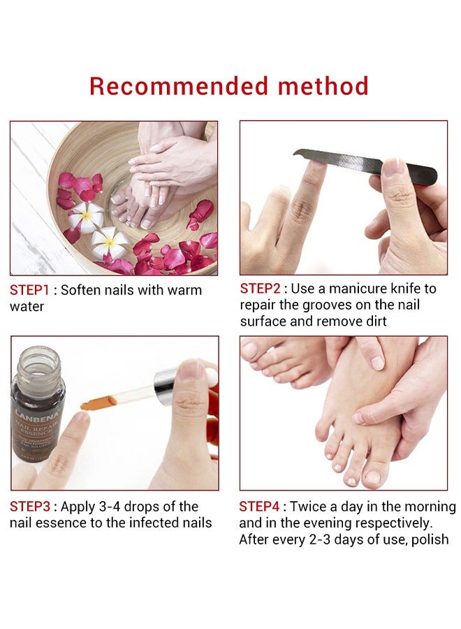 LANBENA Nail Repair Essence, Nail repair, repairs and renews damaged, broken, cracked and discolored nails (15ml) - Image 5