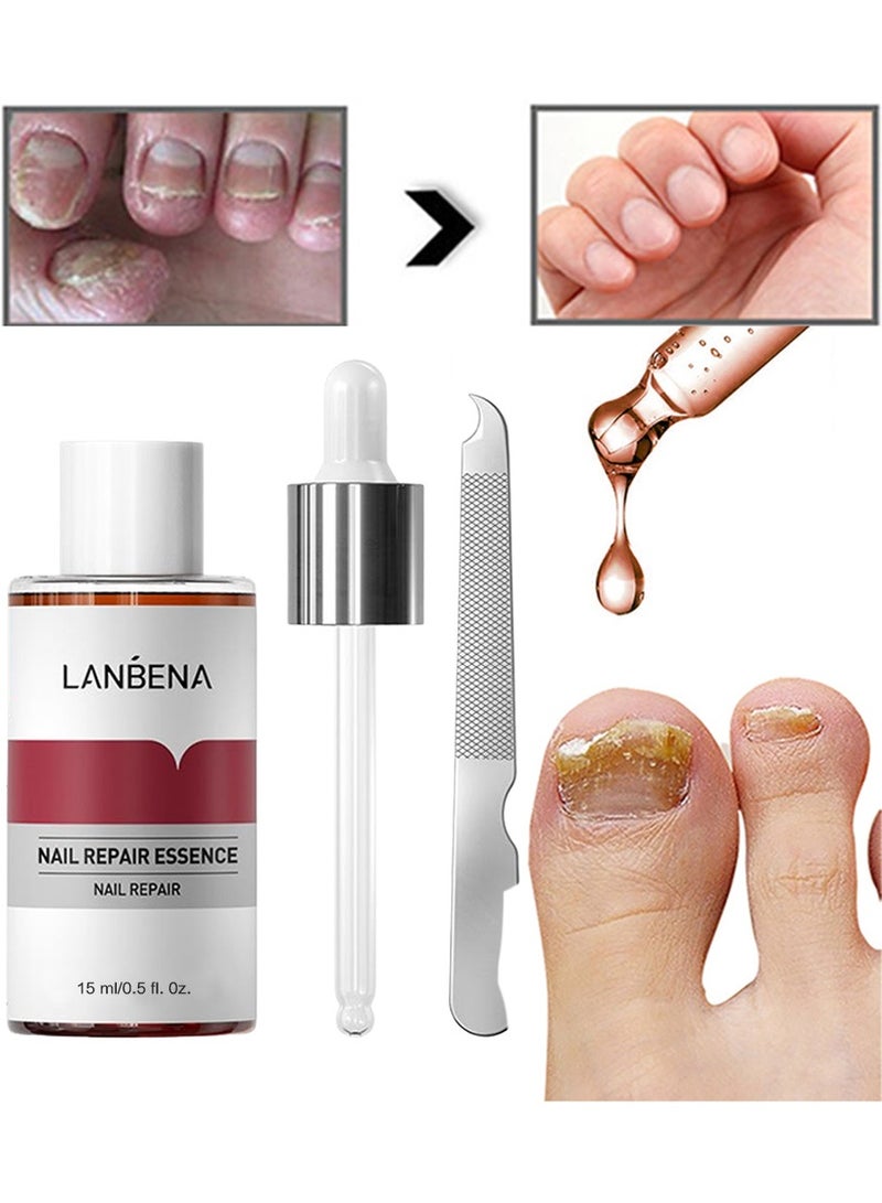 LANBENA Nail Repair Essence, Nail repair, repairs and renews damaged, broken, cracked and discolored nails (15ml) - Image 1