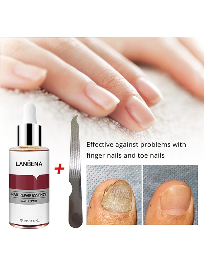 LANBENA Nail Repair Essence, Nail repair, repairs and renews damaged, broken, cracked and discolored nails (15ml) - Image 3
