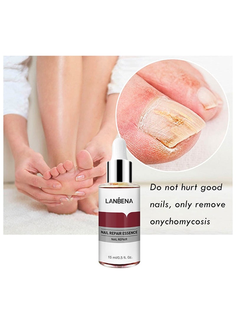 LANBENA Nail Repair Essence, Nail repair, repairs and renews damaged, broken, cracked and discolored nails (15ml) - Image 4