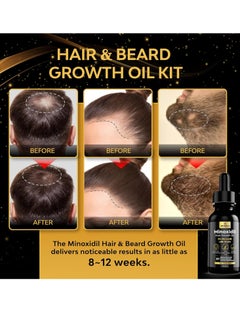 beaueli Minoxidil for Men, Minoxidil for Men Beard Growth Kit, Minoxidil for Women Hair Growth Kit, Hair Regrowth for Men, Beard Growth Serum, Minoxidil 5 Percent  - Image 3