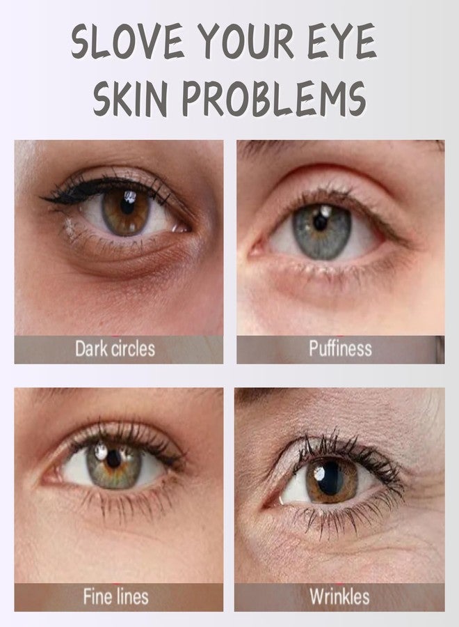 Evolvique Rosehip Under Eye Cream for Dark Circles - Eye Cream Anti Aging - Anti Wrinkle eye cream for Puffiness and Bags Under Eyes - Firming Eye Serum for Women - Best Under Eye Treatment for Bags - Image 4