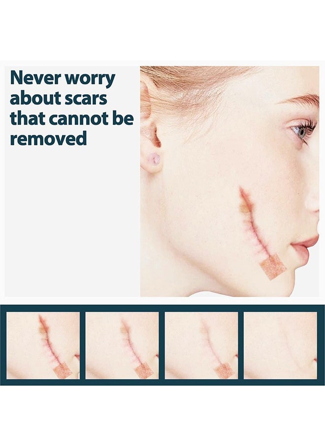 Horse Silicone Scar Sheets - As Surgical Cream, Gel, Tape, Strips, Patches - Keloid, C-Section, Tummy Tuck - Surgery Scars Removal Treatment (10 Pack, 4cmx15cm)  - Image 2