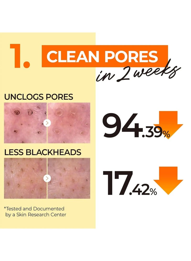 Easy Peasy About this item numbuzin No.1 Easy Peasy Cleansing Oil : A cleansing oil that gently melts not only water-proof makeup but also blackheads and sebum. KEY INGREDIENT : Corn Oil, Macadamia Ternifolia Seed Oil Cleansing Waste in Pore 94.39% / Sebum decreased by 26.36% - Image 3