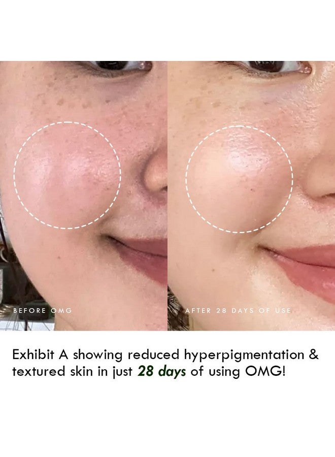 AULI LIFESTYLE Auli 24K Gold Flakes With Pure Rosehip Facial Oil For Normal To Dry Skin Types | Prevents Aging And Hydrates Skin | Glowing And Radiant Skin | Facial Oil For Men And Women | Omg - 30Ml - Image 2