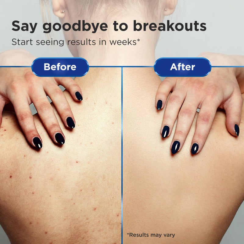 C2P Non-Comedogenic Clear 2 Perfection Shampoo - Sulfate & Paraben-Free for Clear, Healthy Skin & Hair - Esthetician Formulated - Image 5