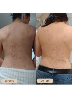 Bushbalm Dark Spot and Hyperpigmentation 2-Step Routine - Includes Dark Spot Treatment Oil (30 ml) and Dark Spot Exfoliating Scrub (236 ml), Bermuda  - Image 5
