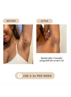 Bushbalm Dark Spot and Hyperpigmentation 2-Step Routine - Includes Dark Spot Treatment Oil (30 ml) and Dark Spot Exfoliating Scrub (236 ml), Bermuda  - Image 4