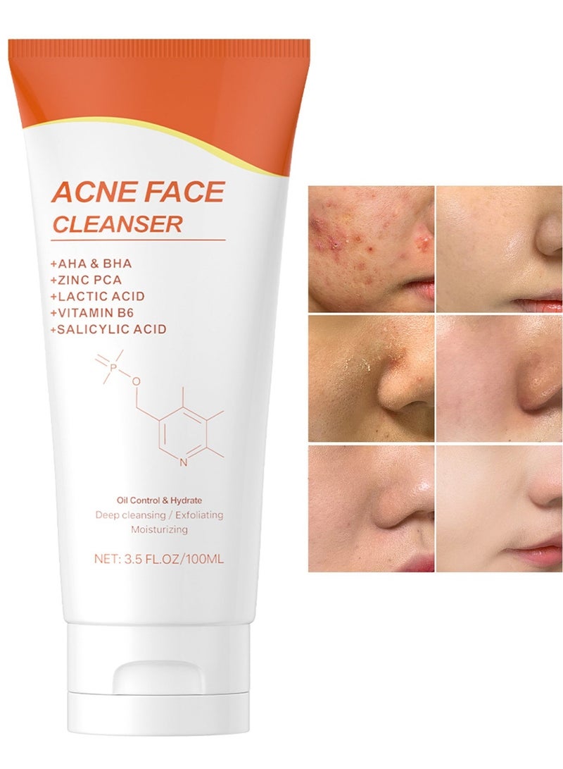 MOOYAM Acne Face Cleanser 100ml for Oily and Problem Skin with AHA BHA Zinc PCA and Salicylic Acid to Control Oil Hydrate and Deep Cleanse Exfoliating Moisturizing Formula - Image 1