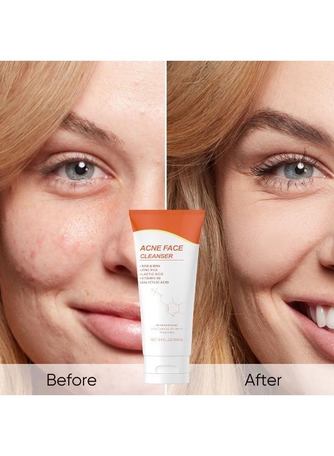 MOOYAM Acne Face Cleanser 100ml for Oily and Problem Skin with AHA BHA Zinc PCA and Salicylic Acid to Control Oil Hydrate and Deep Cleanse Exfoliating Moisturizing Formula - Image 3