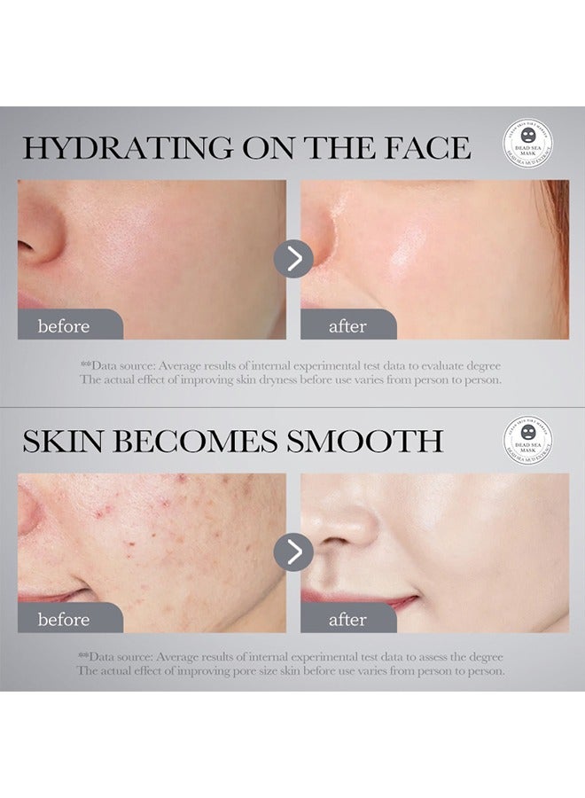 BIOAOUA Whitening Mud Mask-Clean Pores Whitening Skin, Dead Sea Mud Mask For Face Acne Oily Skin & Blackheads Minimizes Pores & Improves Overall Complexion 8g*5PCS - Image 5