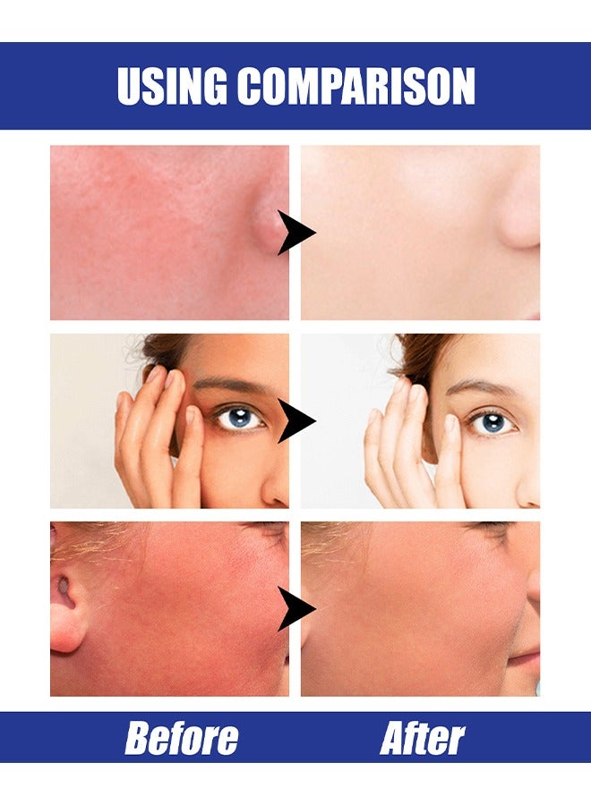 إيلهو عصا الشمس جيدة التهوية بحمض الهيالورونيك ، عصا واقية من الشمس خفيفة الوزن للوجه ، واقي من الشمس مرطب للوجه حماية قوية من الأشعة فوق البنفسجية ، غير لامع طويل الأمد غير دهني مقاوم للماء SPF 50+ PA ++++ - Image 3