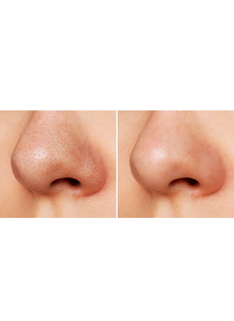 Ce-tua - Nose Pore Strips Pineapple Flavor - 3 Strips - Image 1