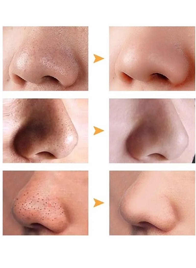Ce-tua - Nose Pore Strips Pineapple Flavor - 3 Strips - Image 1