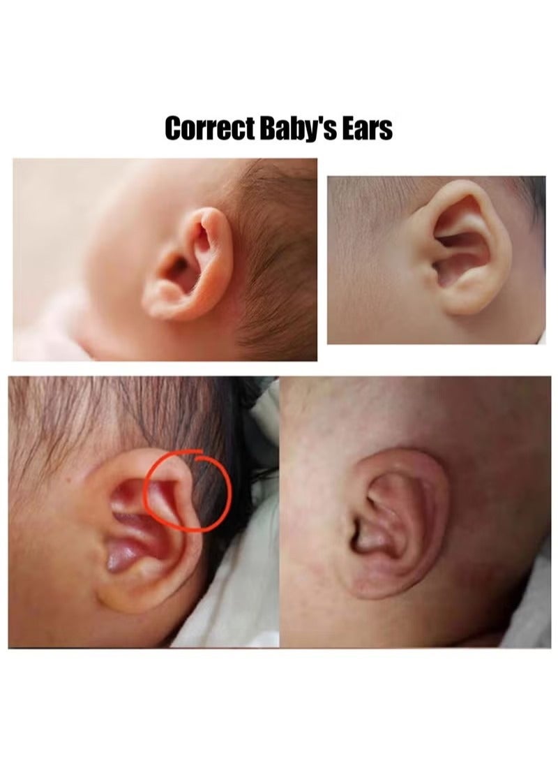Auricle Valgus Correction Patch for Baby, Children Ear Correction, Newborn Baby Ear Aesthetic Correctors, Infant Protruding Ear Stickers (4cm*100cm) - Image 5