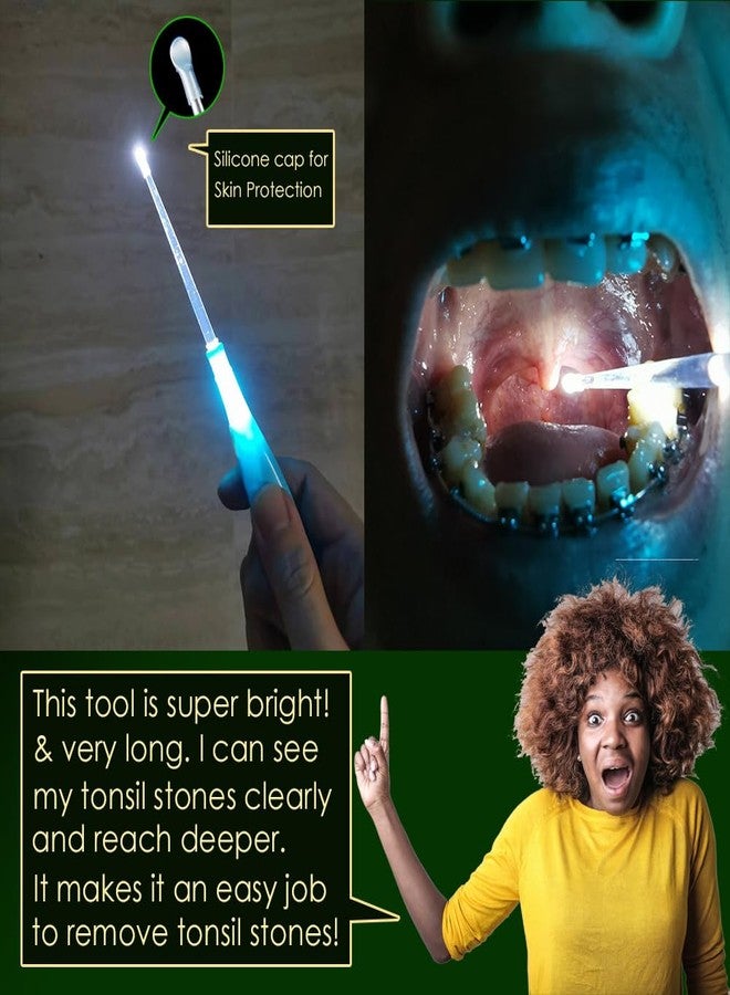 ACDelco Professional 45D10712 وصلة كروية سفلية أمامية لنظام التعليق - Image 4