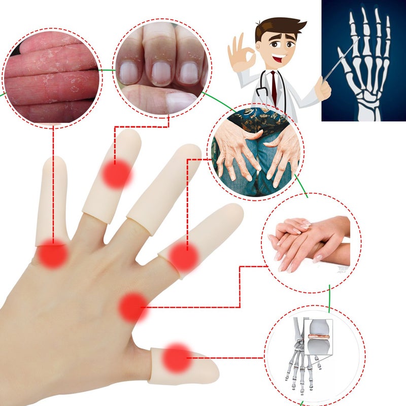 Pnrskter Gel Finger Cots, Finger Protector Support(14 PCS) NEW MATERIAL Finger Sleeves Great for Trigger Finger, Hand Eczema, Finger Cracking, Finger Arthritis and More. (10pcs Long + 4pcs Short) - Image 2