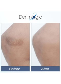 Dermlogic Vitamin K Cream- Moisturizing Bruise Healing Formula. Dark Spot Corrector for Bruising, Spider Veins & Broken Capillaries. Reduces Under Eye Dark Circles, Fine Lines, Puffiness, & Wrinkles with Arnica  - Image 4