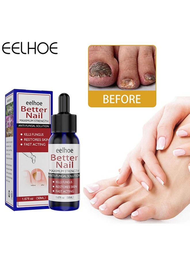 إيلهو مسمار إصلاح السوائل - Image 1