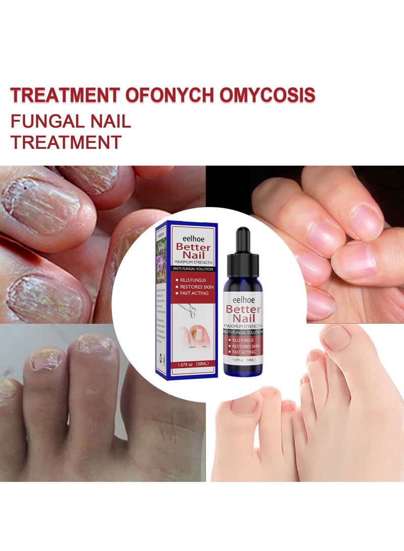 إيلهو مسمار إصلاح السوائل - Image 3