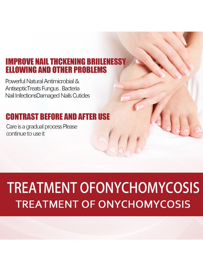 إيلهو مسمار إصلاح السوائل - Image 5