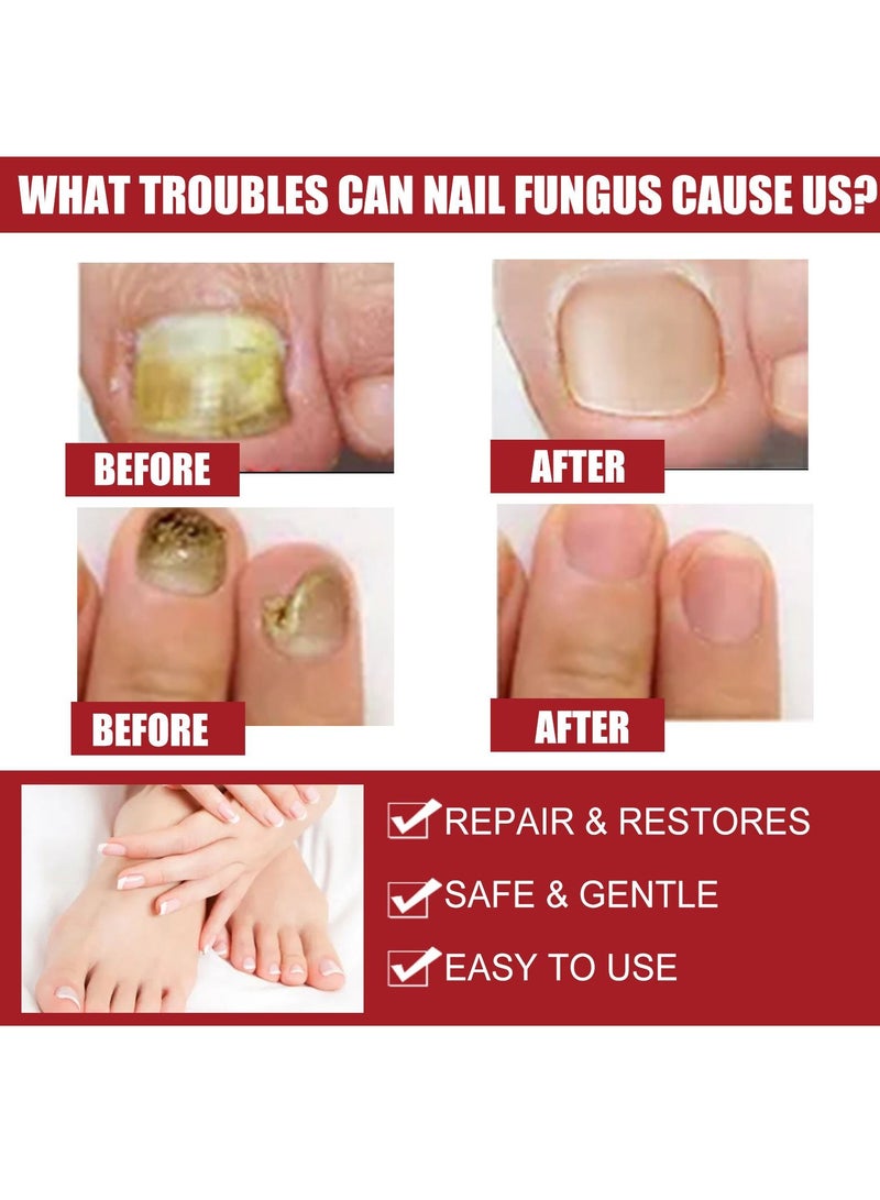 إيلهو مسمار إصلاح السوائل - Image 4