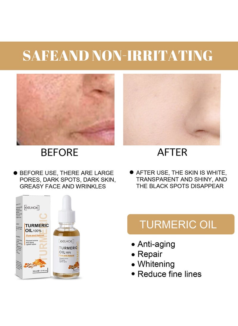 EELHOE - Turmeric Dark Spot Corrector Serum, 30ml Skin Care Moisturizing Repair Serum, Moisturizing And  Brightening Turmeric Oil For Acne, Dark Spots, Hyperpigmentation, Smooth Skin - Image 1