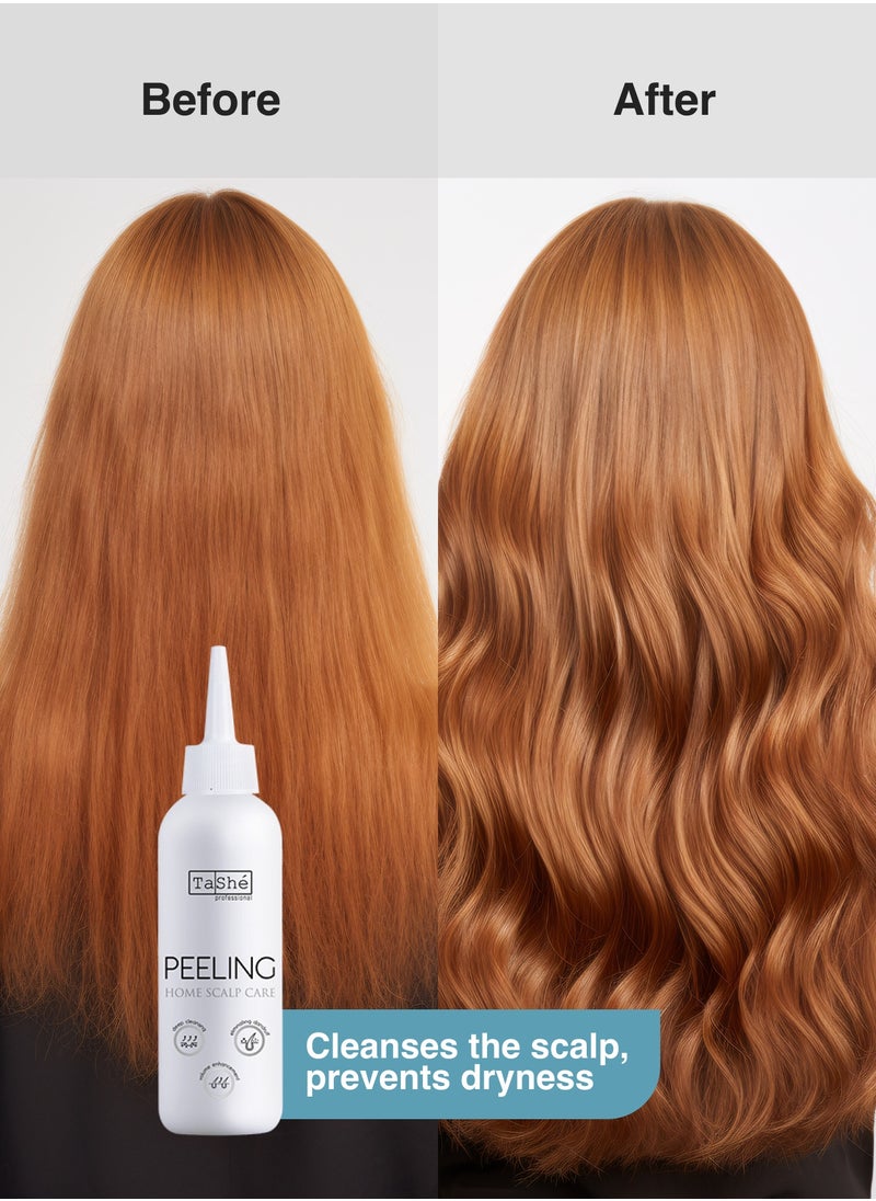 Anti-Dandruff Scalp Peeling Treatment with Menthol, Panthenol & AHA Acids, 100 ml