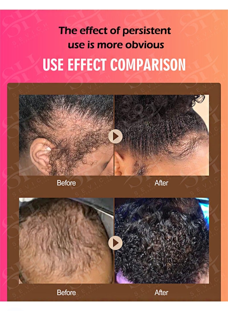 Sevich Batana Oil Hair Shampoo，Batana Hair Care，Repair Damaged Hair，Nourishes Loss Hair Growth Fir for All Hair Types（100ml） - Image 5