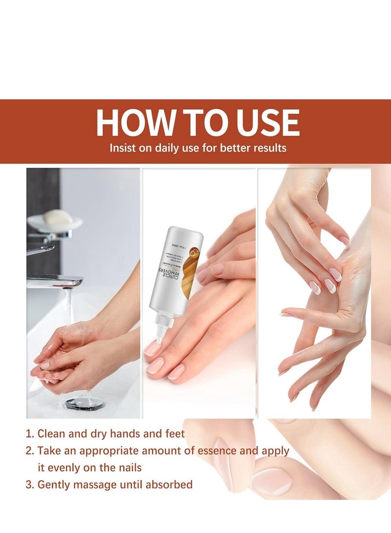إيلهو كريم مزيل البشرة ، العناية المهنية بالأظافر ، جل مزيل بشرة الأظافر ، ترطيب ، مزيل بشرة مقوي ، للأظافر الهشة ، تعليق الأظافر + بشرة جافة ، مزيل بشرة فوري 30 مل - Image 5