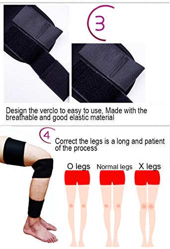Mcvcoyh Leg Correction Device, XO-Type Leg Correction Belt, 3 Sets Legs Corrector Belt Band Straighten Belt Durable Material - Image 5