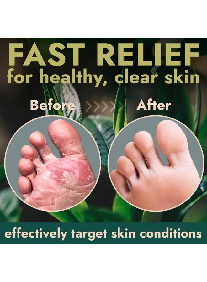 Terramed Just Think Comfort Foot Spray with Tea Tree Oil | Antifungal Treatment for Jock Itch, Nail Fungus & Ringworm | Fast Absorbing & Deep Penetrating Relief | Soothes Itching & Burning | 120ml - Image 5