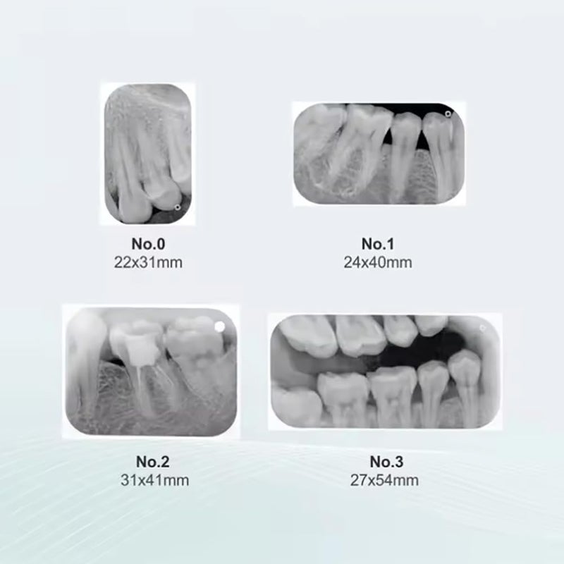 ألواح تخزين الفوسفور PSP لأشعة الأسنان الموديل 1 مع مغناطيس لعيادة بيطرية ومختبر - Image 4