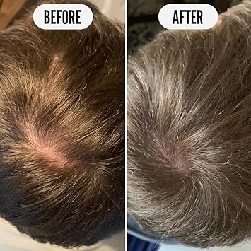 NOUGHTY KMI Brands Noughty Get Set Grow Tonic Leave in Treatment for Thicker and Fuller Looking Hair 97 Natural 75ml White - Image 4