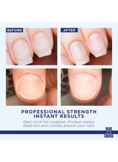 Blue Cross Blue Cross Cuticle Remover Liquid, Cuticle Softener for Nails, Professional Nail Care with Lanolin for Brittle Hang Nails, Hydrating, Moisturizing, Dry Cuticles, Made in USA, 6oz  - Image 2