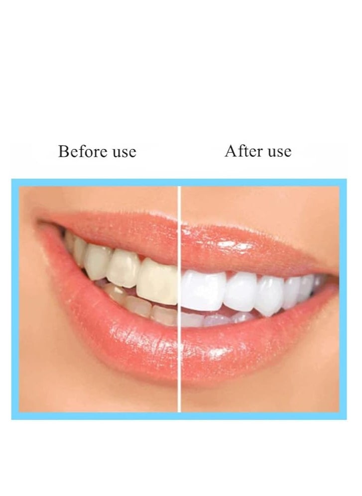 Generic - Teeth whitening lamp inbuilt - Image 1