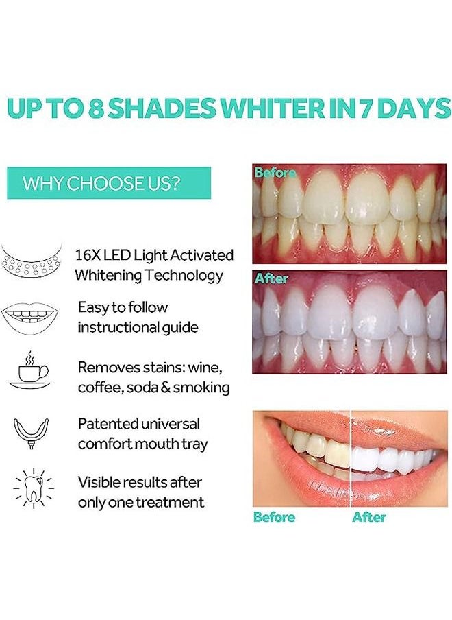 GlorySmile - LED Teeth Whitening Device Gel Tooth Bleaching System Portable Dental Whitener USB Charge Home Teeth Care Tool - Image 1