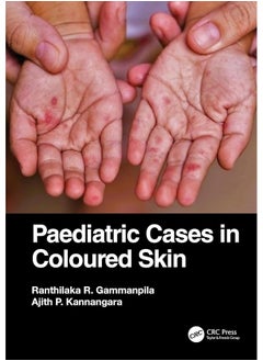 Paediatric Cases in Coloured Skin - pzsku/Z2AA353252CA25626F40EZ/45/_/1740557601/ecf4367b-c6f1-4a20-93de-95d540c7321c